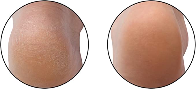 Microplane Personal Care - Sole Surfer Foot File